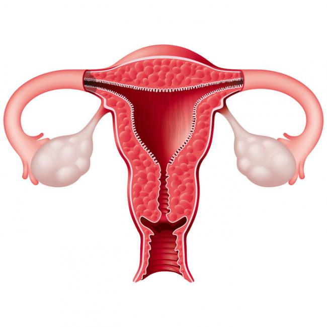 Le myo-inositol : Utilisation dans le syndrome des ovaires polykystiques 